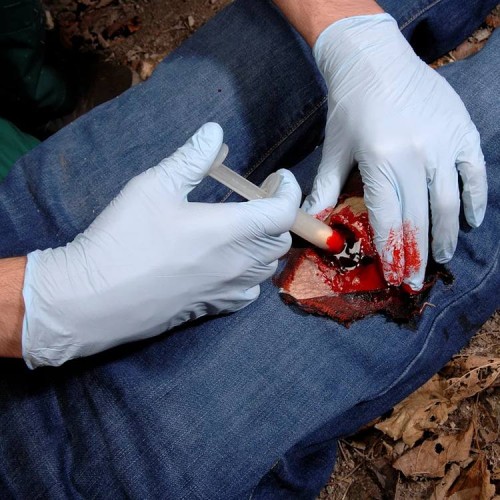 Аппликатор гемостатический с гранулами Rhino Rescue в Орле хитозановый